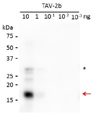 2b protein [Tomato aspermy virus] in the group Antibodies Plant/Algal  / Plant Pathogens / Viruses at Agrisera AB (Antibodies for research) (AS16 3982)